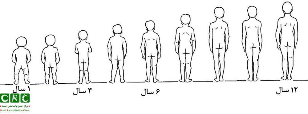 روند طبیعی رشد پای کودکان چگونه است؟