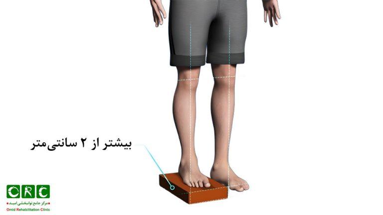 کوتاهی پا