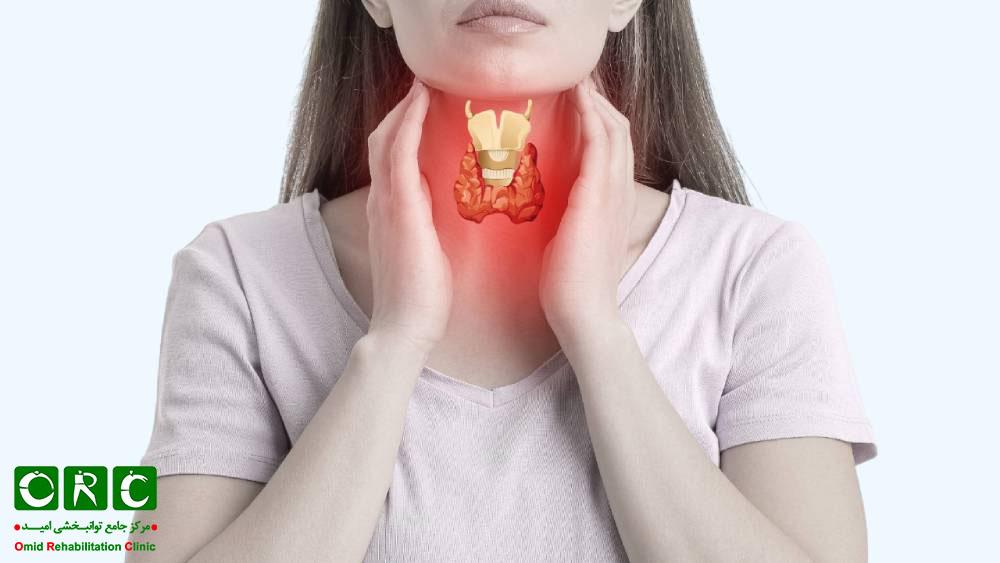 داغی کف پا به دلیل کم کاری تیروئید