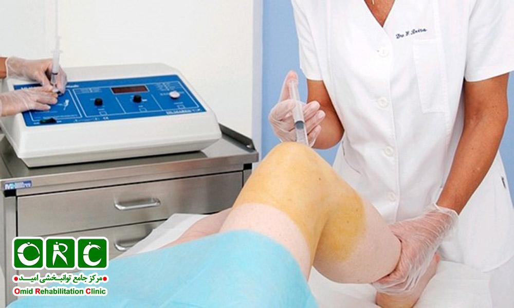تزریق اوزون و ژل هیالورونیک اسید یا پی آر پی به صورت همزمان برای کاهش درد زانو