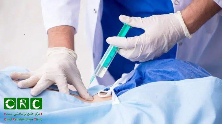 تزریق آمپول جهت درد کمر