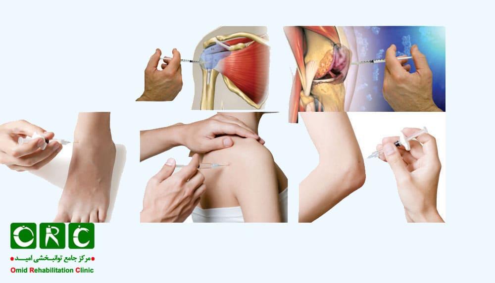 مشکلات اسکلتی - عضلانی