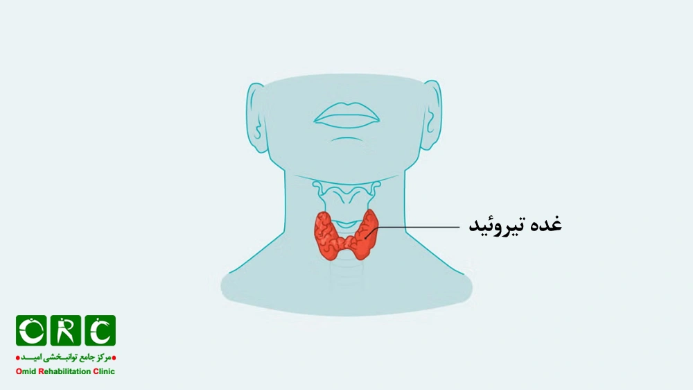 کم‌کاری تیروئید 