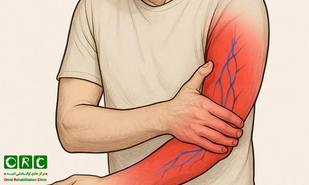 مشکلات عروقی