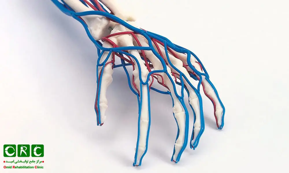 مشکلات عروقی